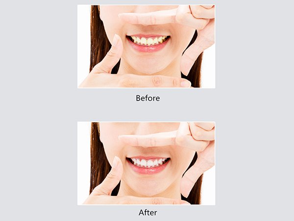 Five Brushing Modes, Suitable for All Ages
